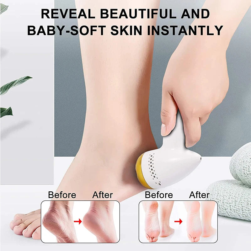 Pedicure Machine Callus Remover Pedicure Tools Professional Foot Dead Skin Remover Foot Grinder Electric Foot Grinder Elec