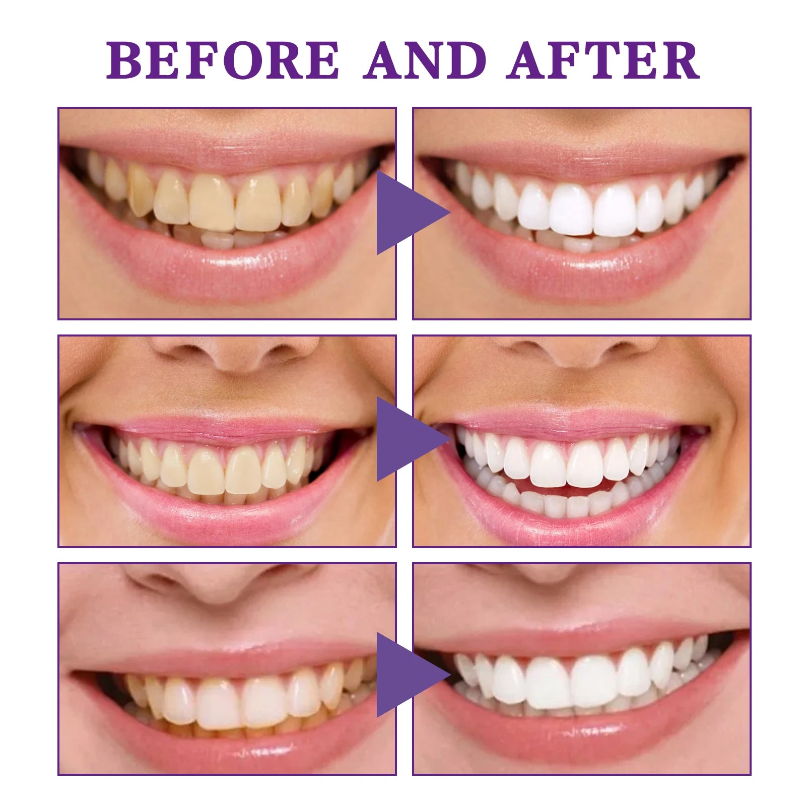 V34 Teeth Whitening Mousse, Purple Color Corrector Toothpaste, Dental Care, 30ml